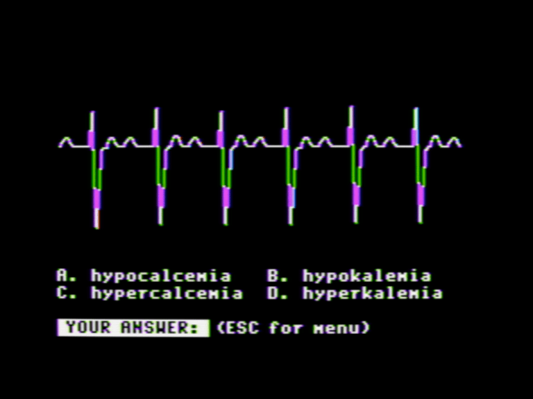 EKG Teaching: Rhythm Strip screenshot 4 of 4
